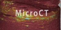 MicroCT