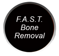 F.A.S.T. Bone Removal