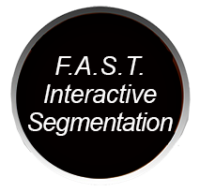 F.A.S.T. Interactive Segmentation