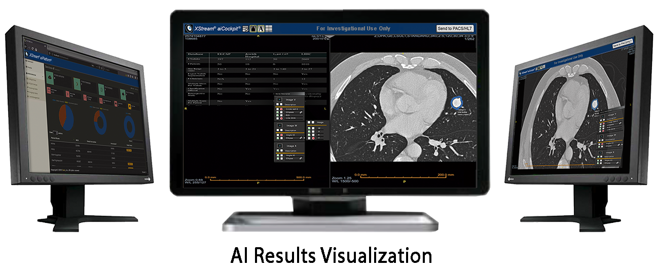 Fovia Advanced Visualization Software Platform