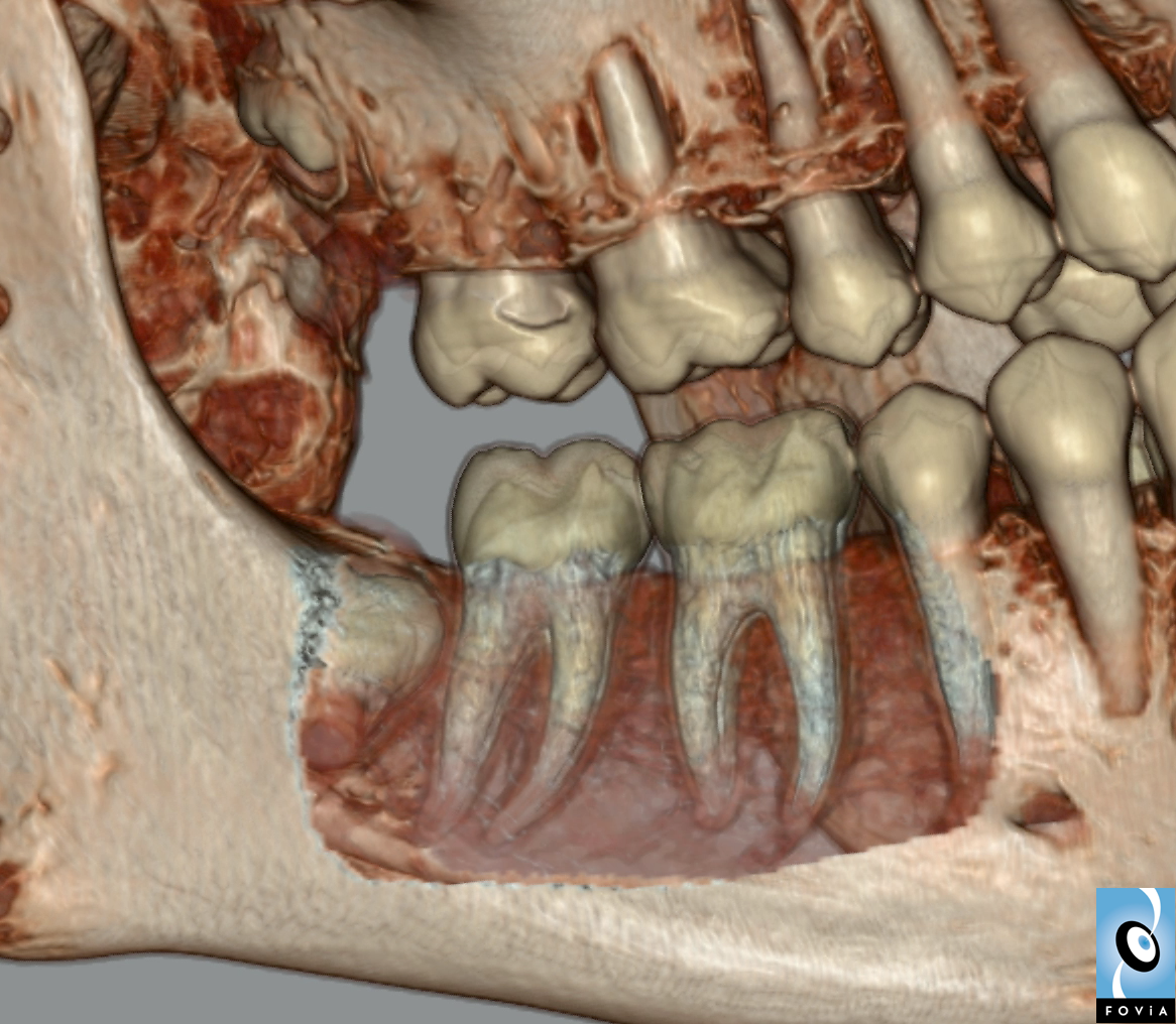 Teeth Roots