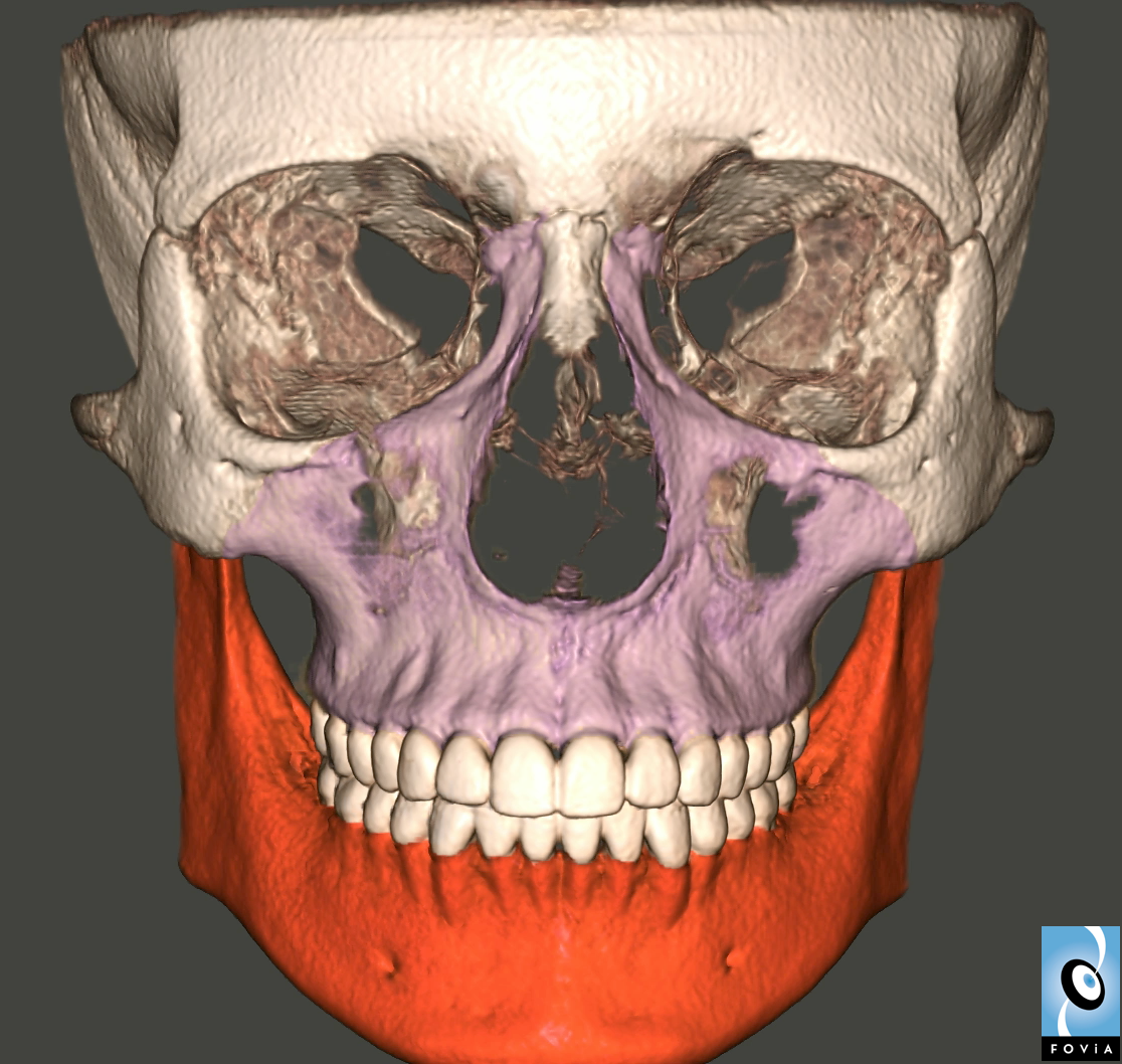 Craniofacial Segmentation