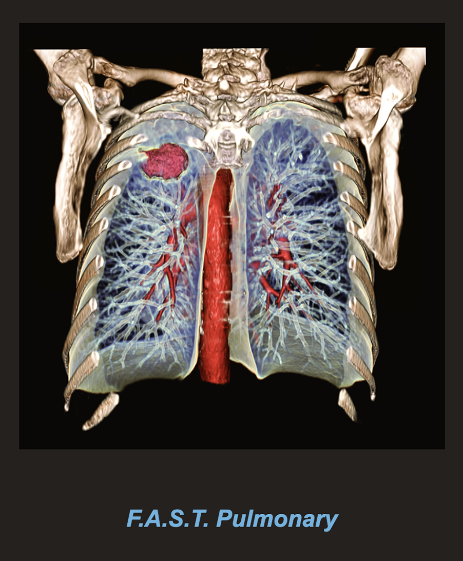 F.A.S.T. Pulmonary