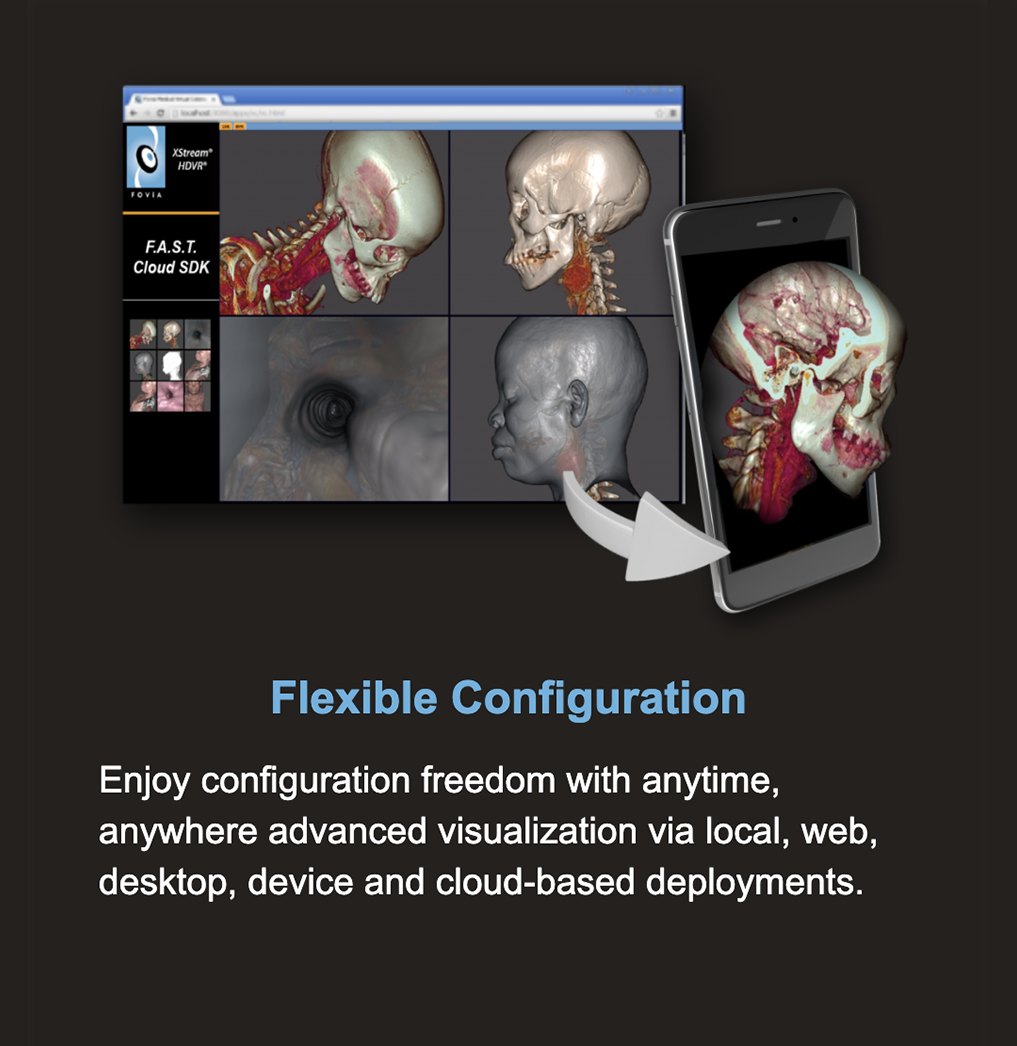 Flexible Configuration