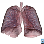 lung3small