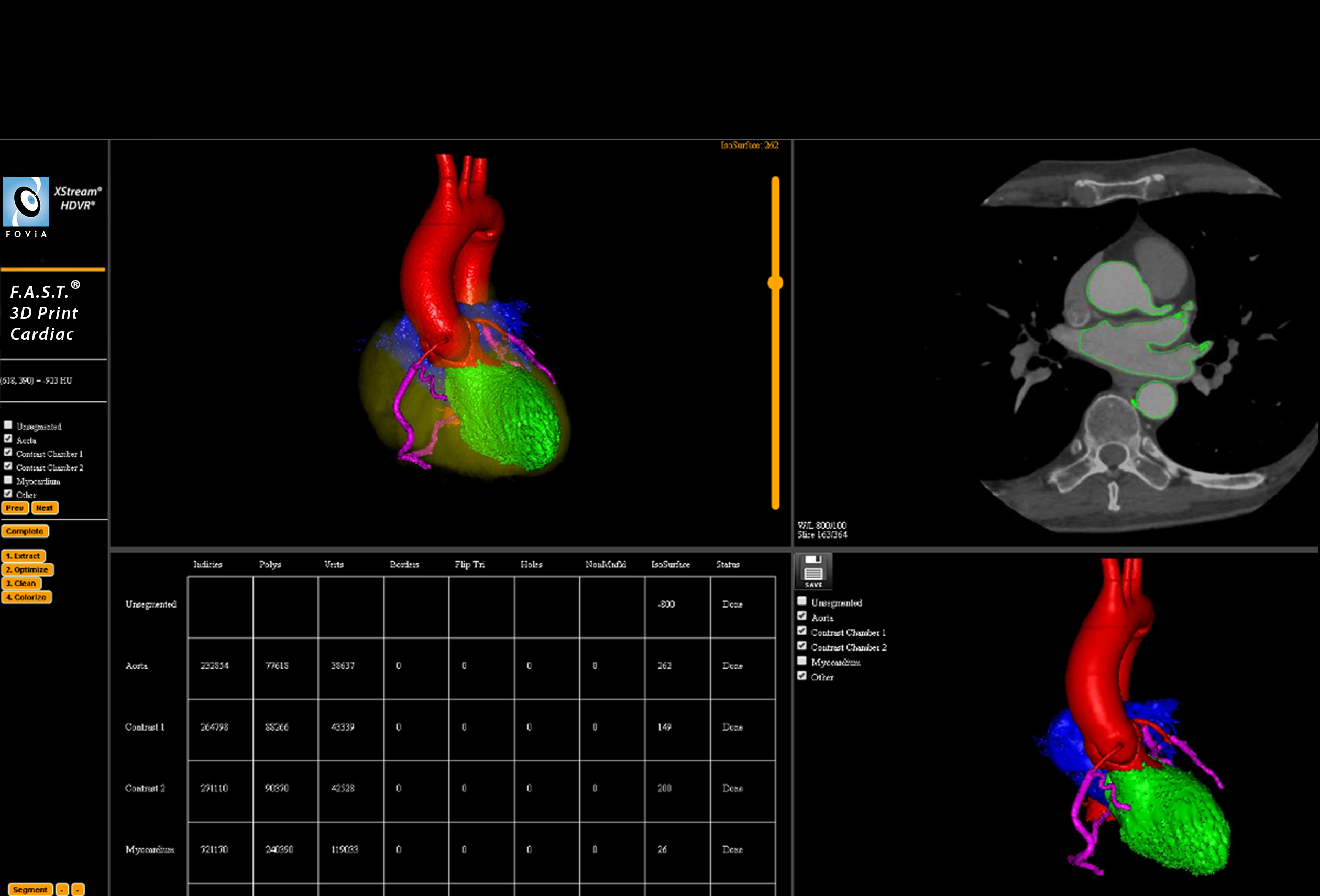 F.A.S.T. 3D Print Cardiac Workflow