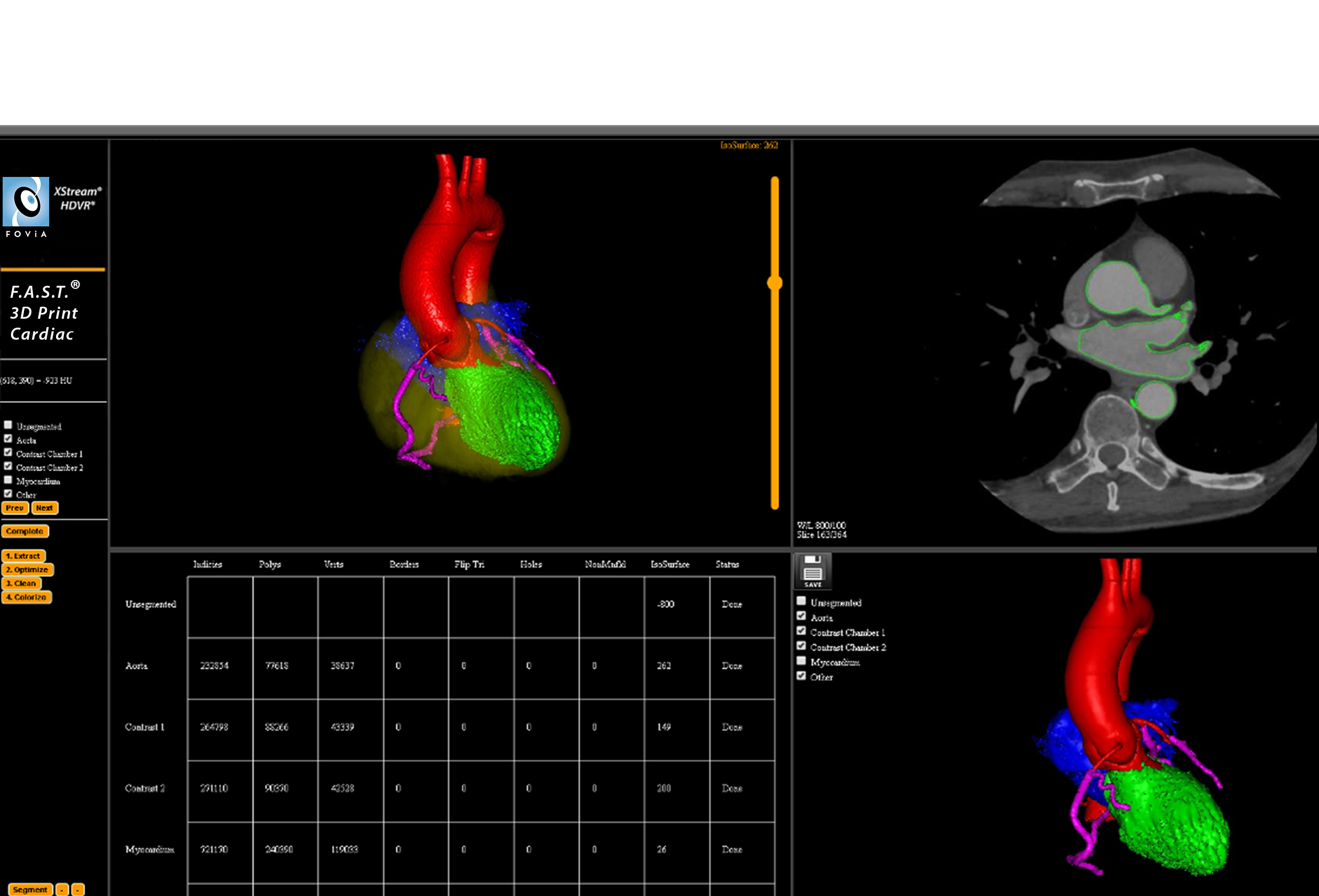 F.A.S.T. 3D Print Cardiac Workflow