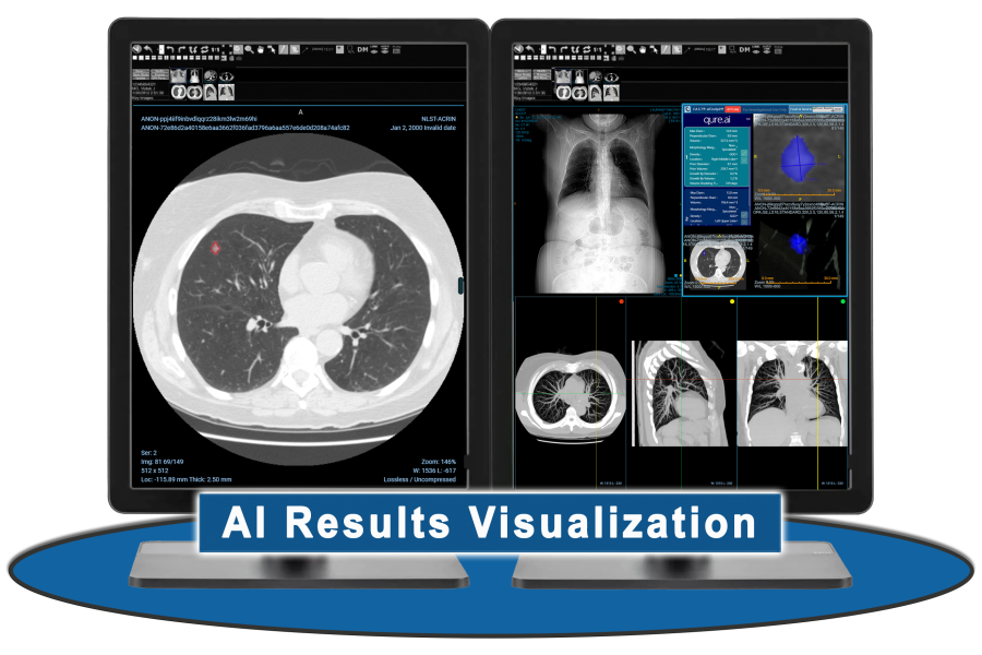 Fovia Ai Software Integrations